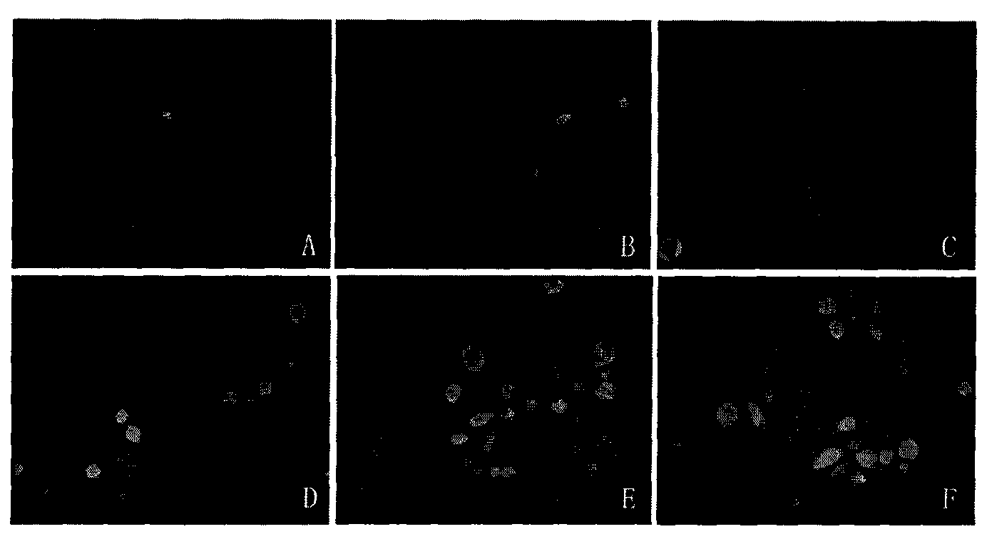 Method for selectively replicating replication-defective adenovirus and application