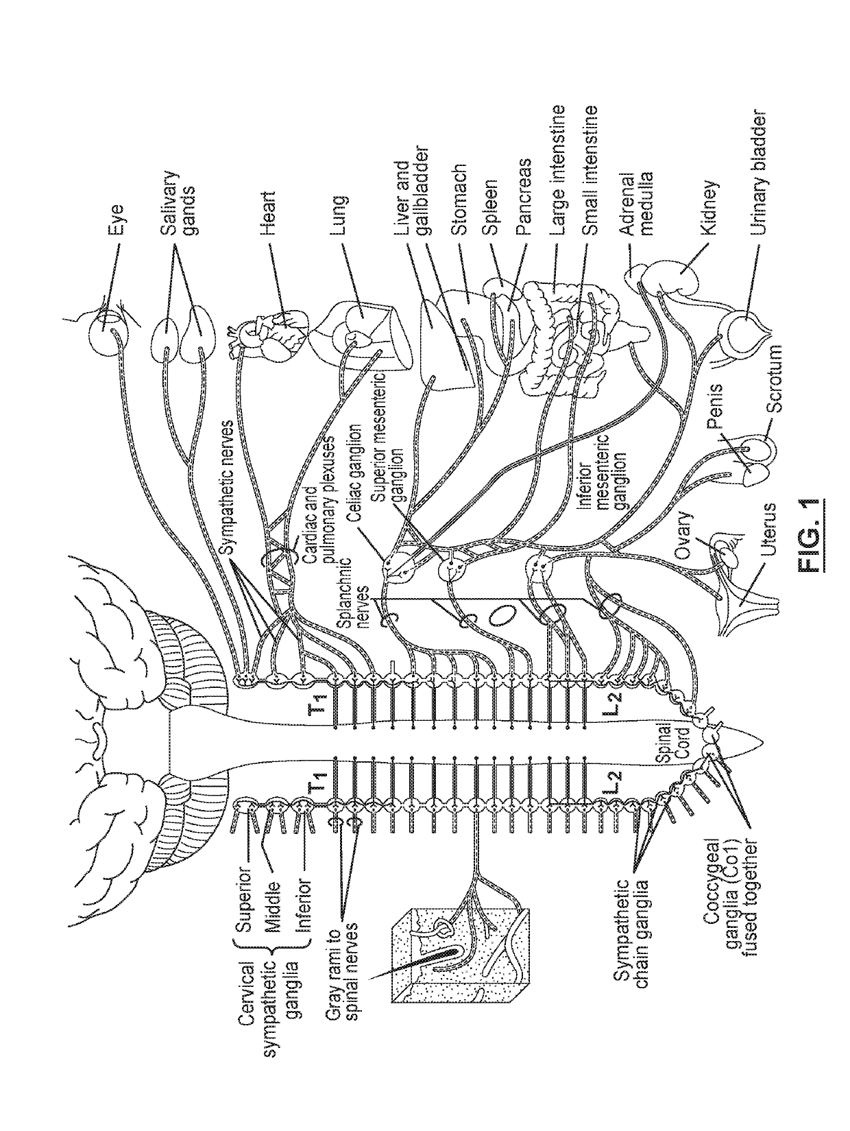 Devices and methods for treatment of heart failure via electrical modulation of a splanchnic nerve