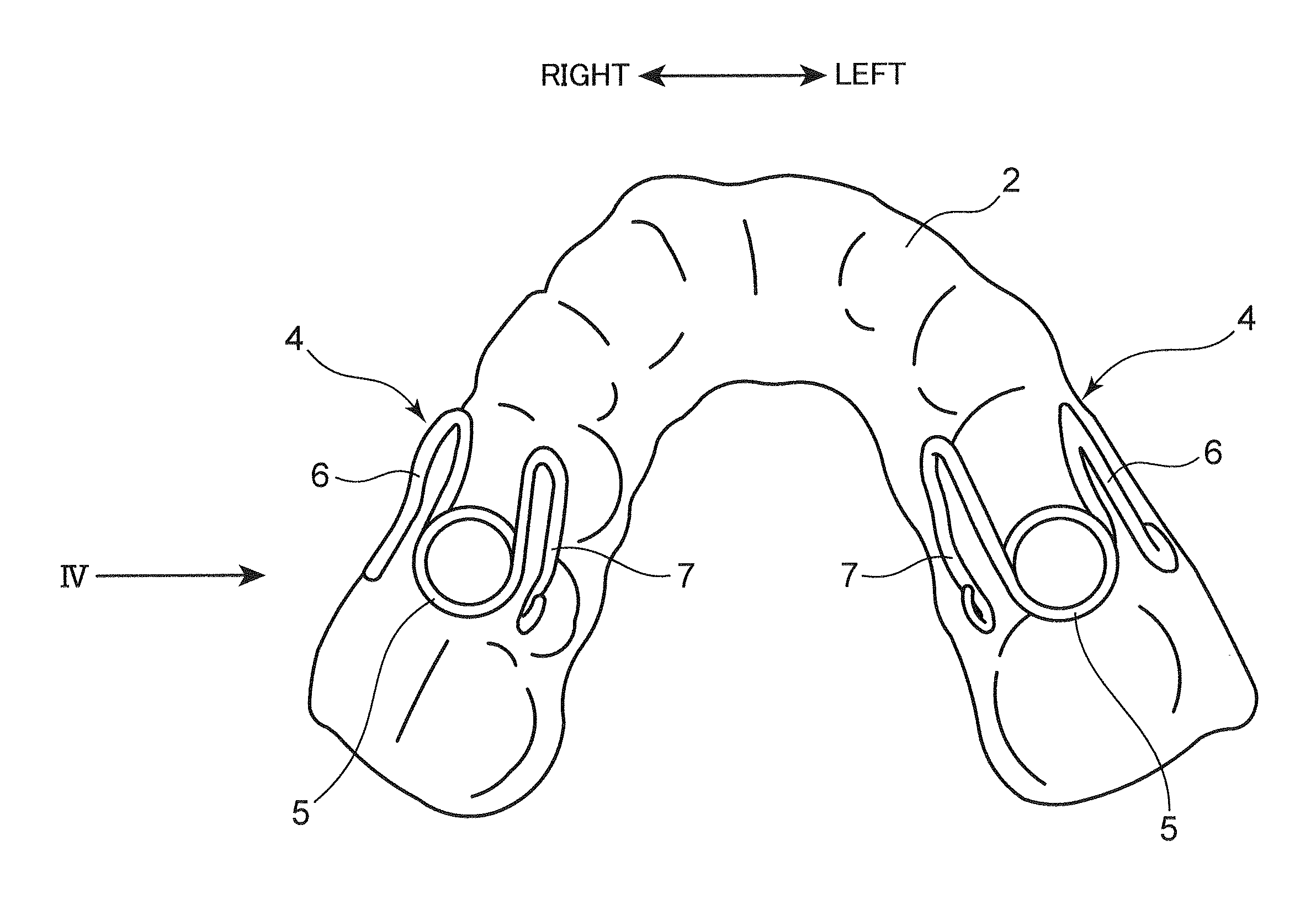 Mouthpiece