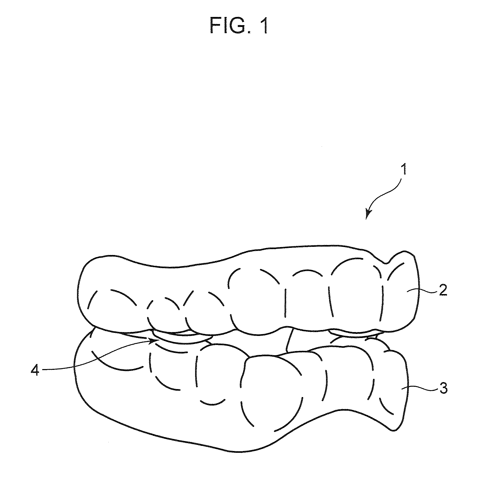 Mouthpiece