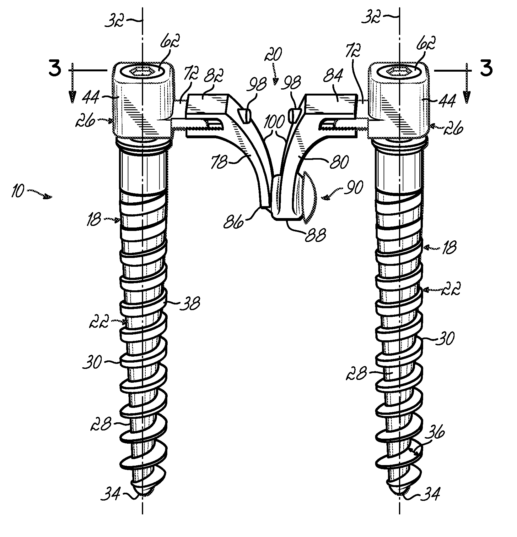 Dynamic spinal stabilization system and method of using the same