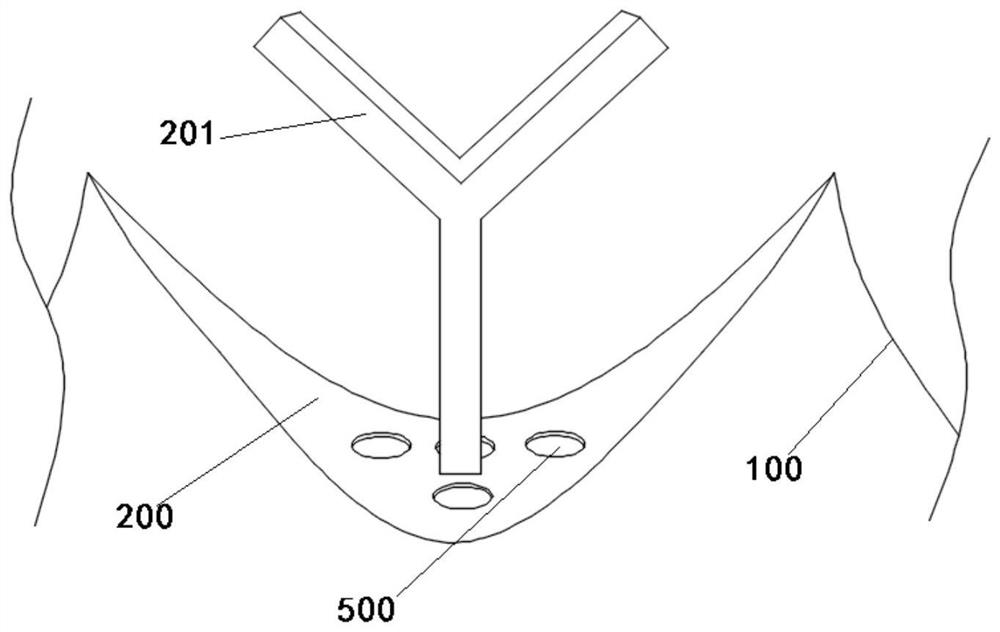 Titanium alloy denture bracket and manufacturing method thereof