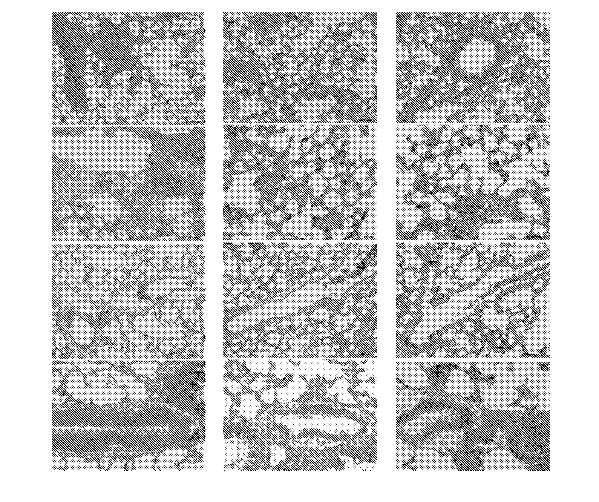 Compositions and methods for prevention and treatment of pulmonary hypertension