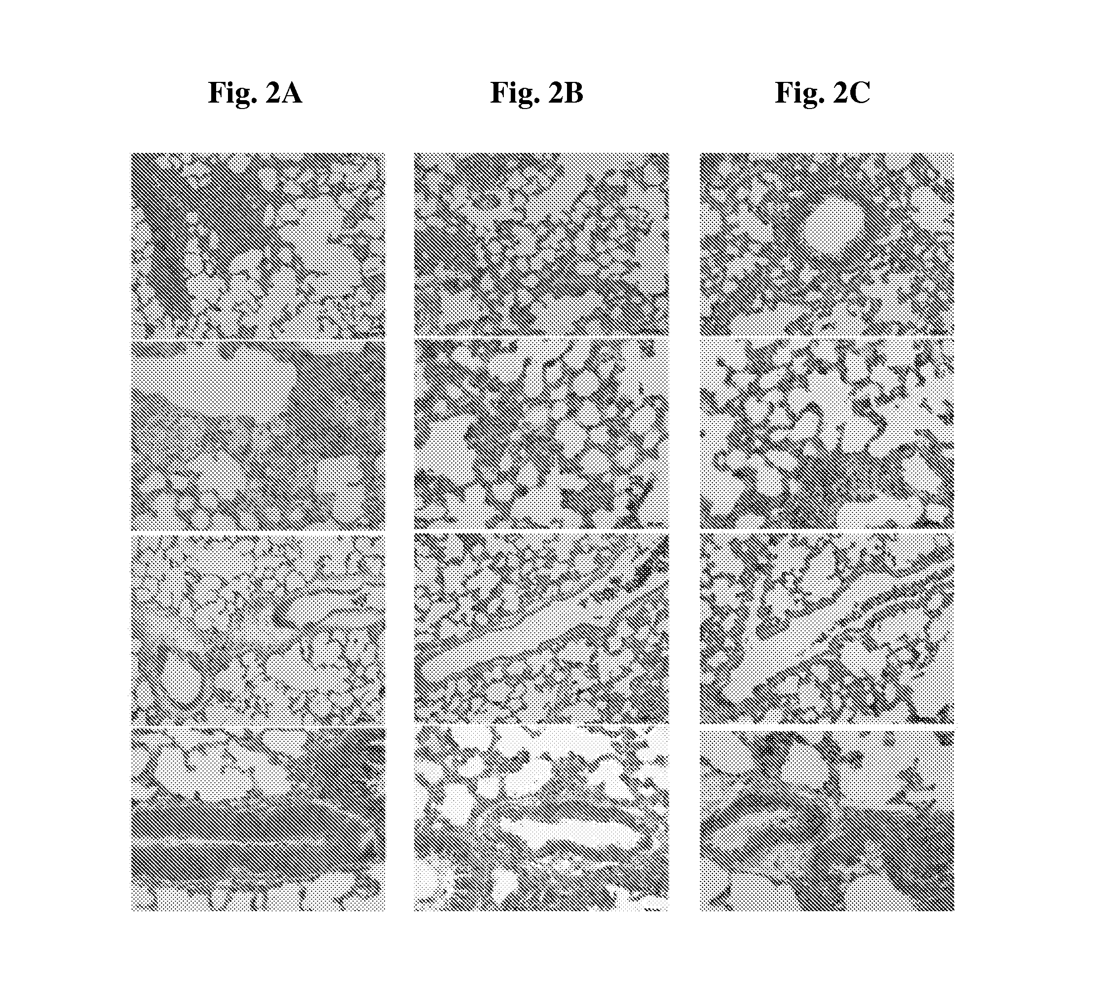 Compositions and methods for prevention and treatment of pulmonary hypertension