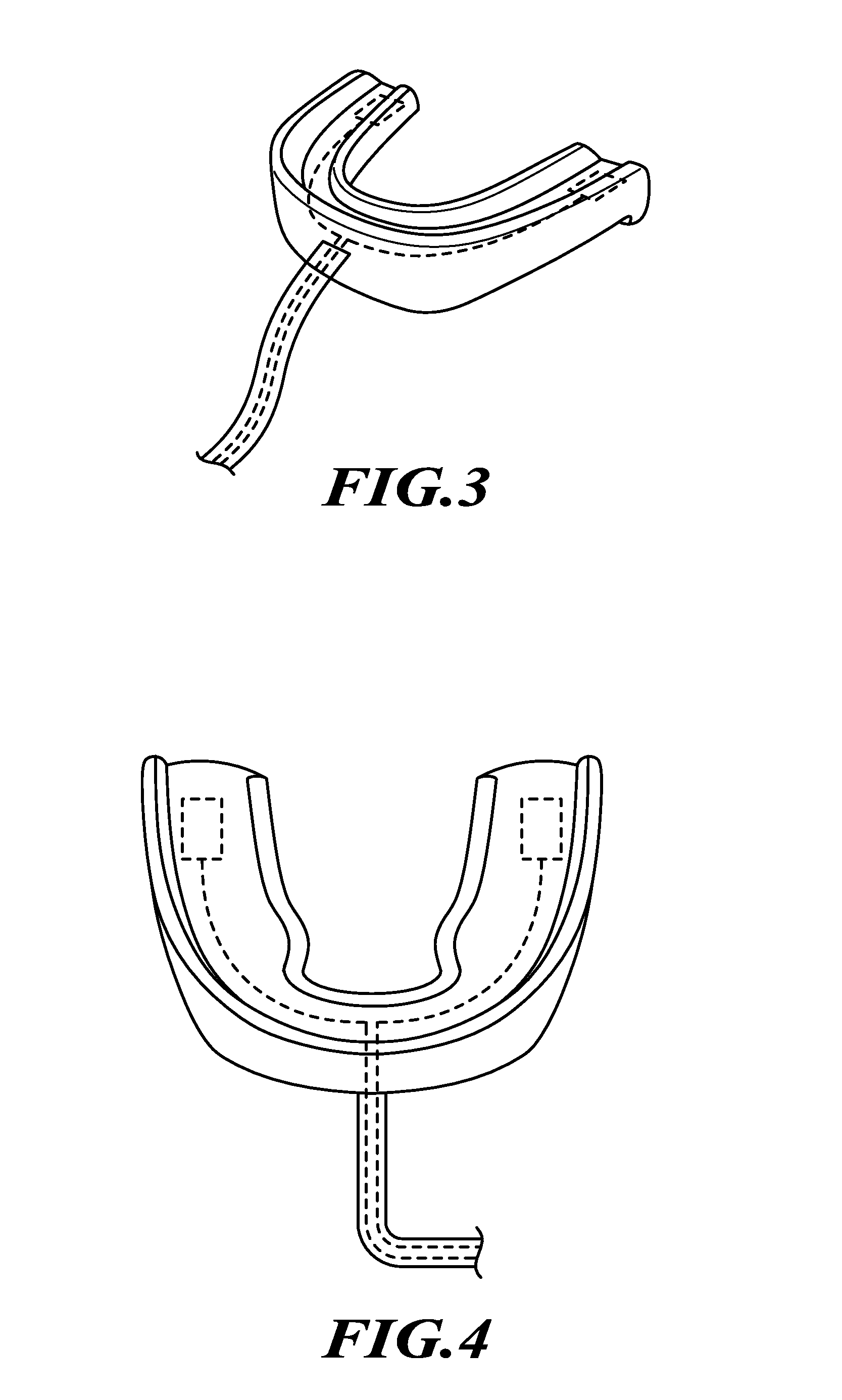 Mouth guard formation methods