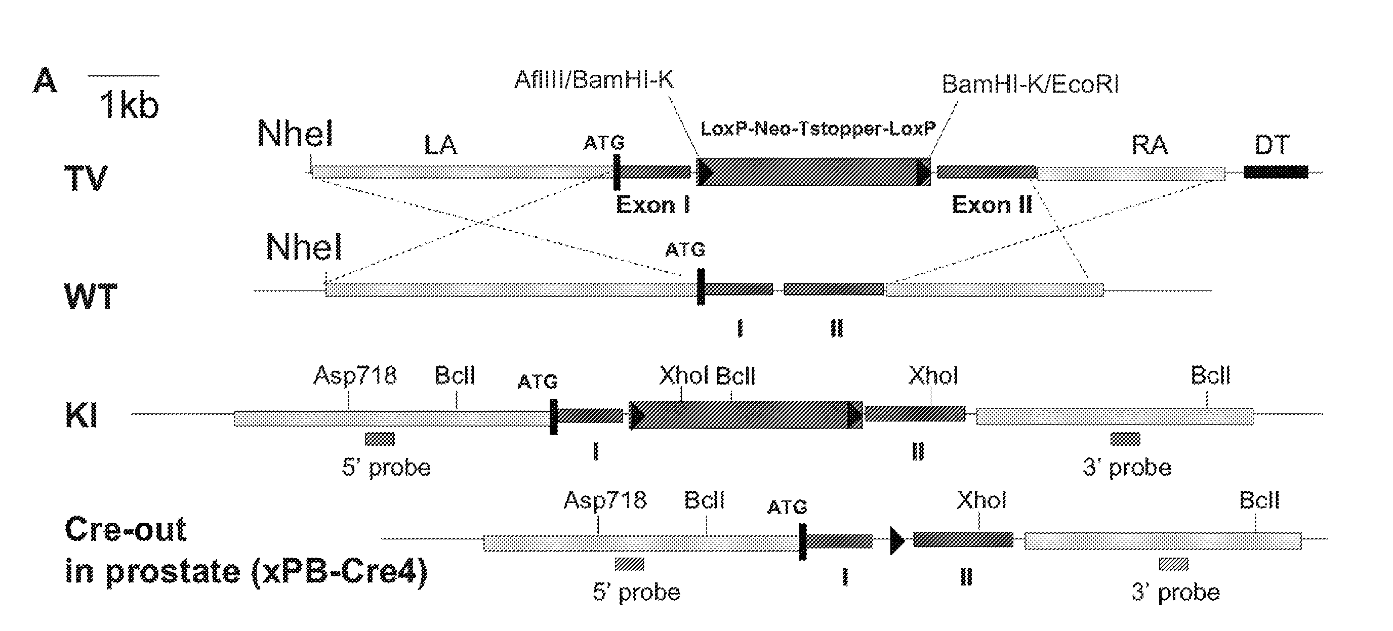 Signatures and determinants associated with prostate cancer progression and methods of use thereof