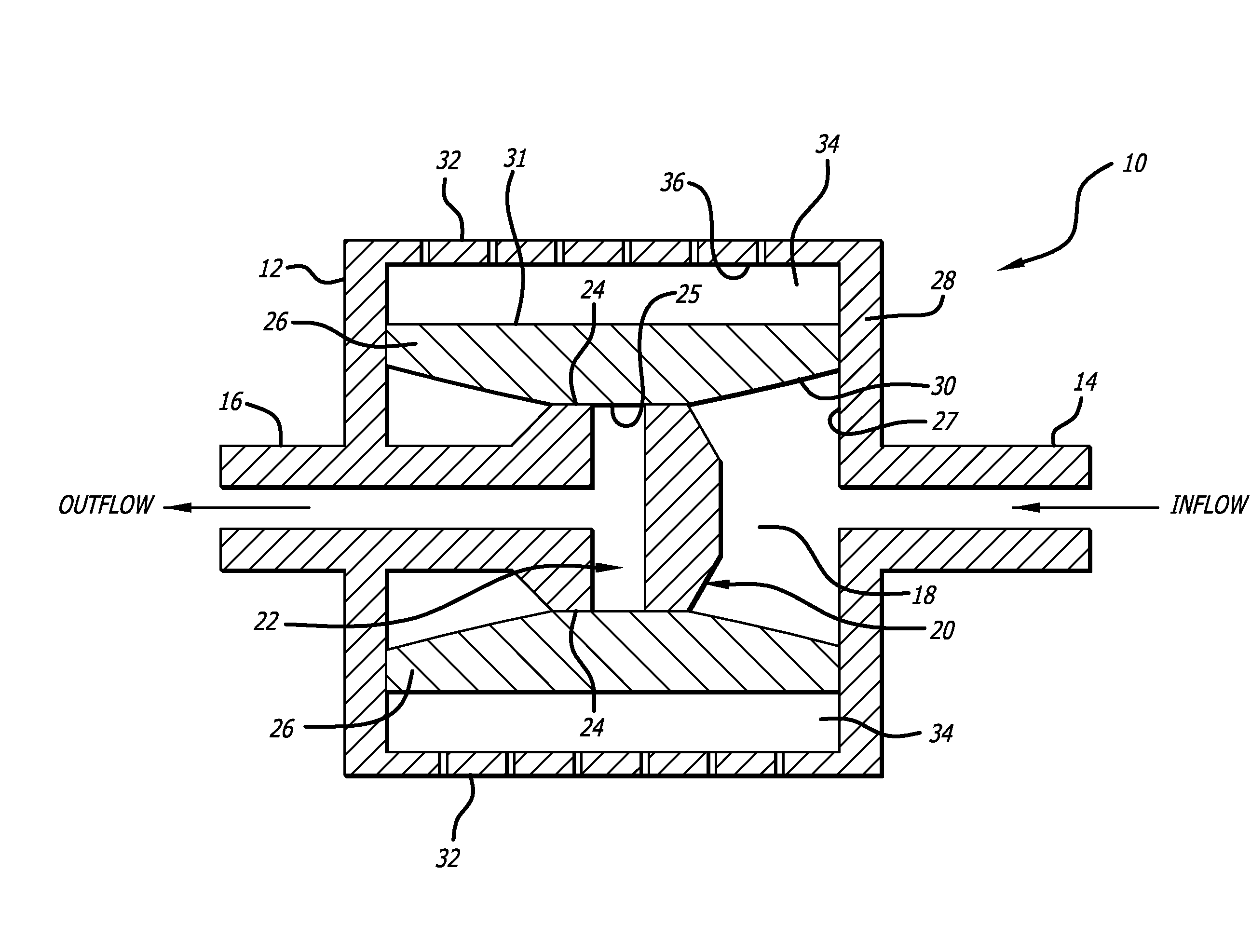 Shunt valve for controlling siphon effect