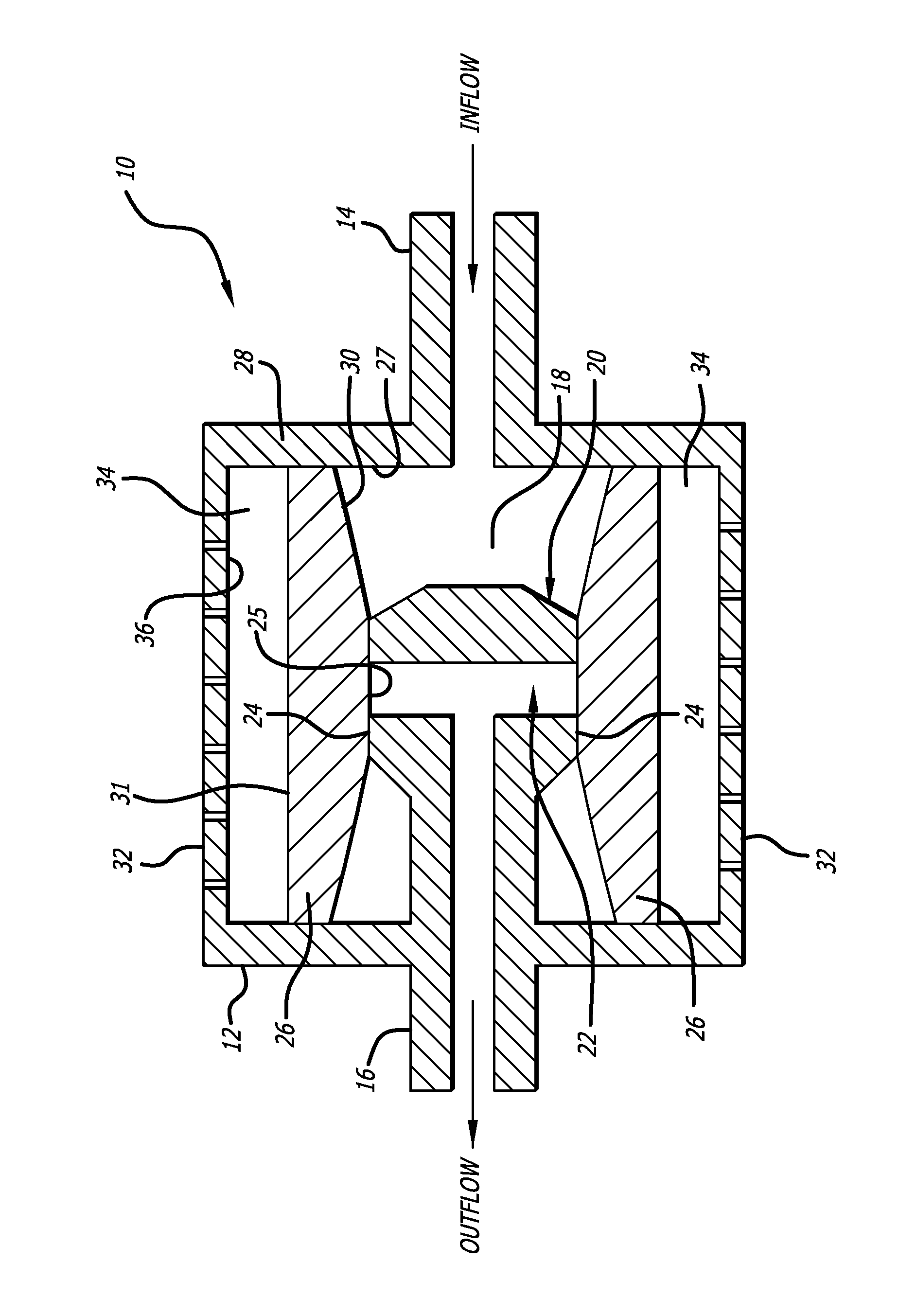 Shunt valve for controlling siphon effect