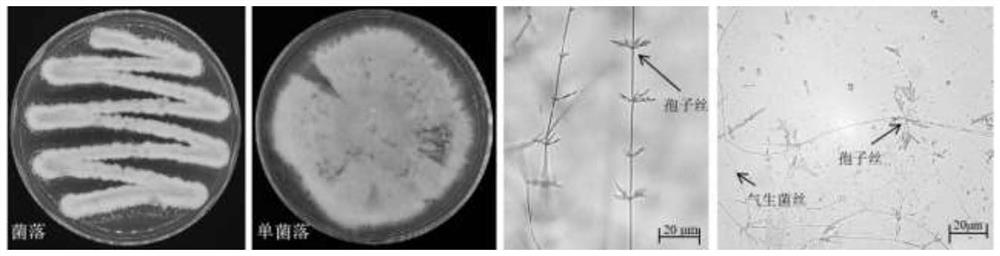 Streptomyces thiogamboges St-79 and application thereof