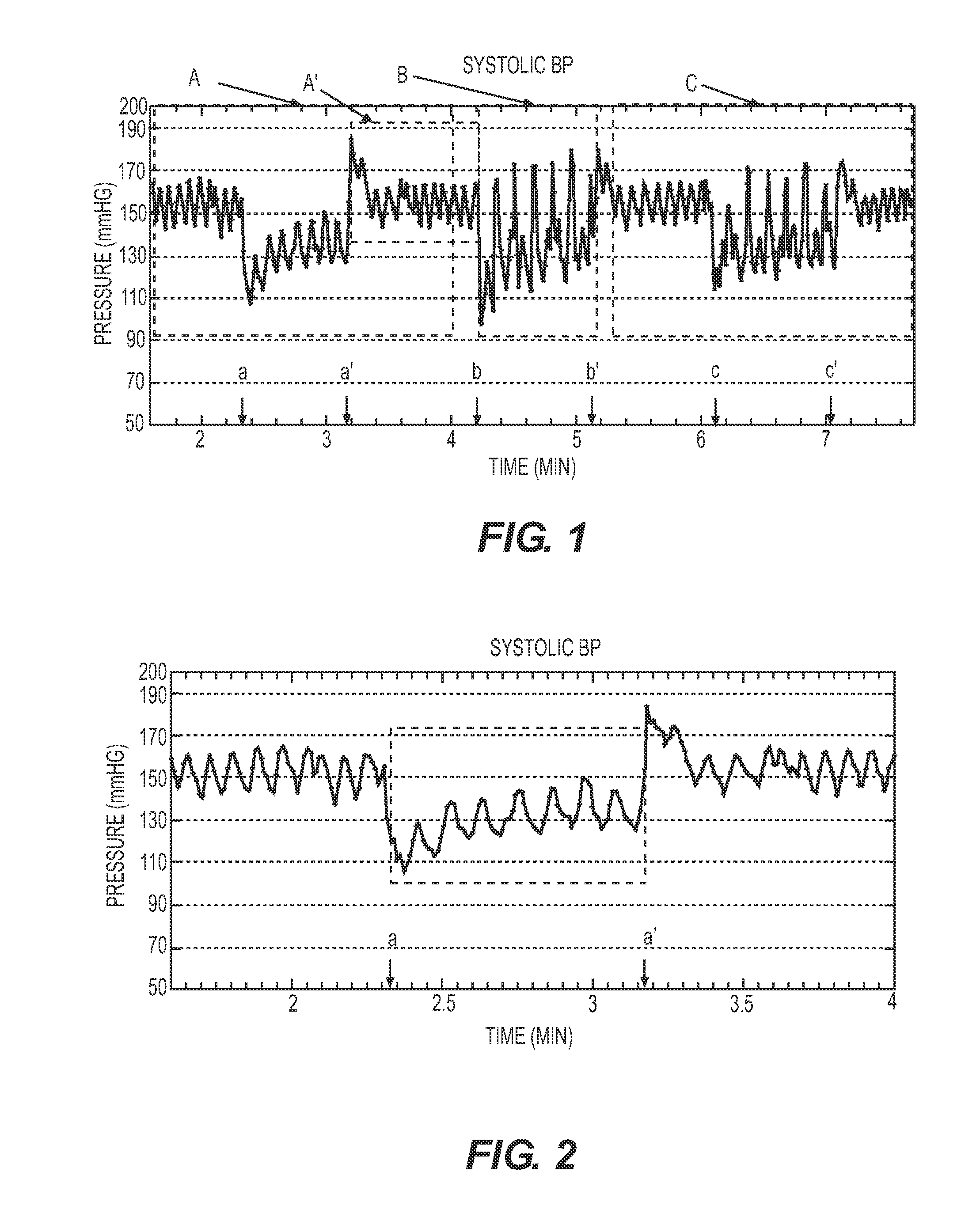 Methods and Systems for Lowering Blood Pressure Through Reduction of Ventricle Filling