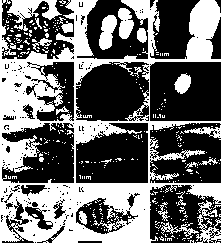 Protein for regulating and controlling chloroplast growth and gene and application thereof