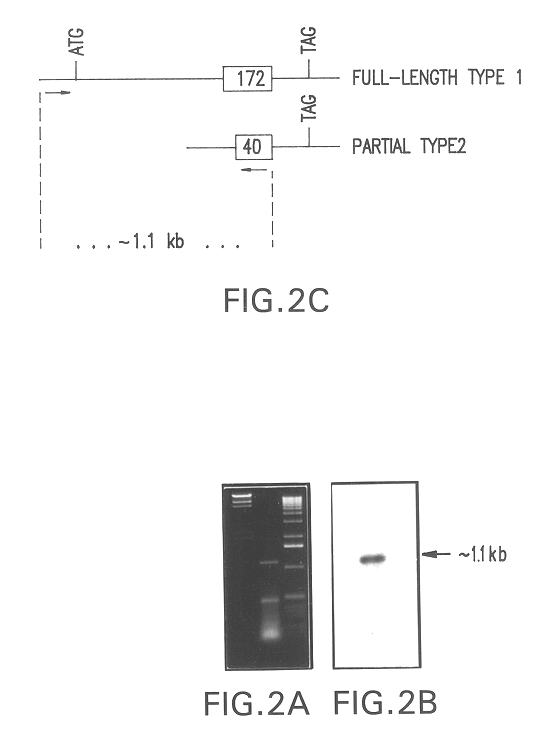 Acid sphingomyelinase protein and methods of treating type B Niemann-Pick disease