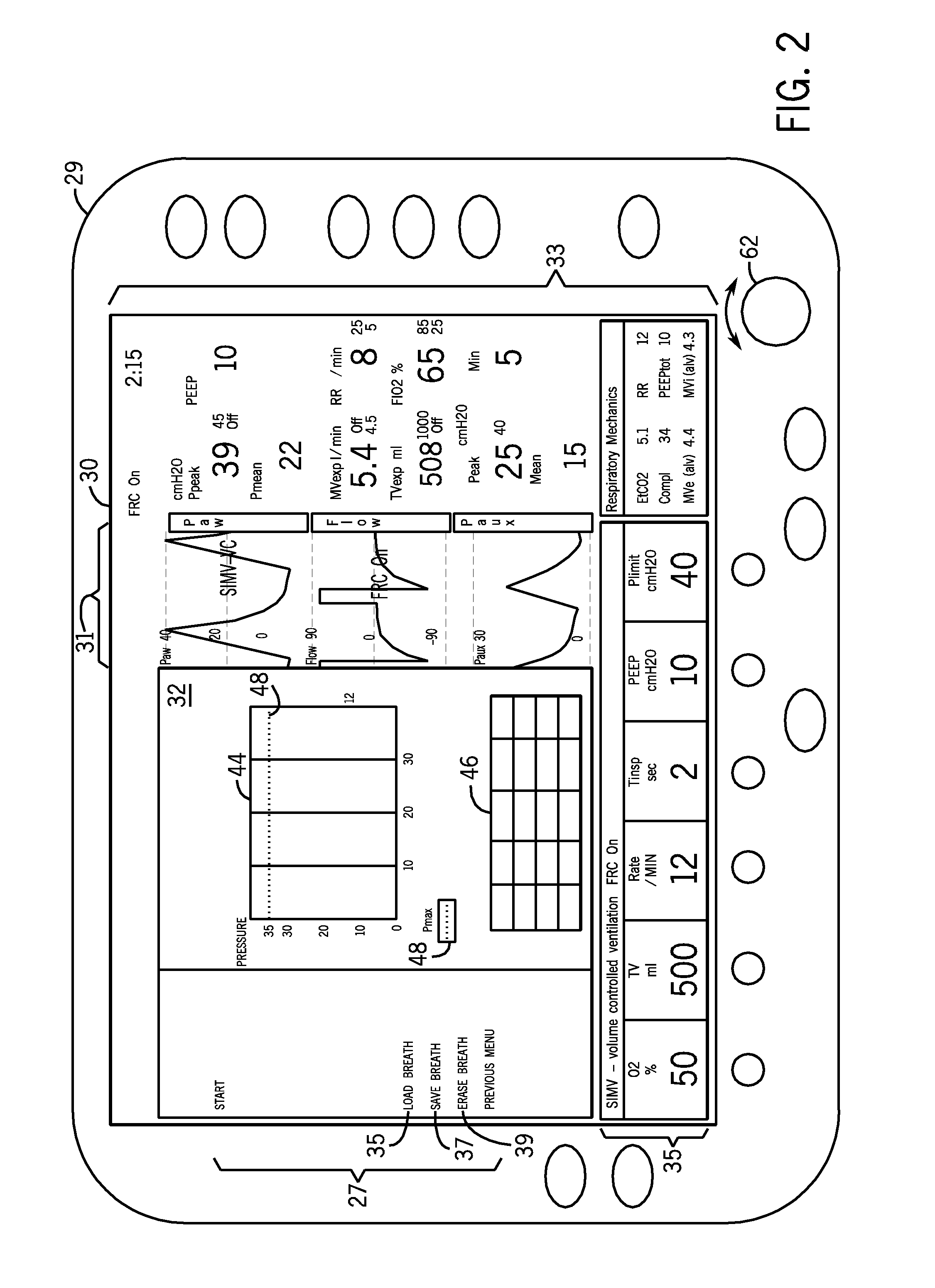 Device and method for graphical mechanical ventilator setup and control