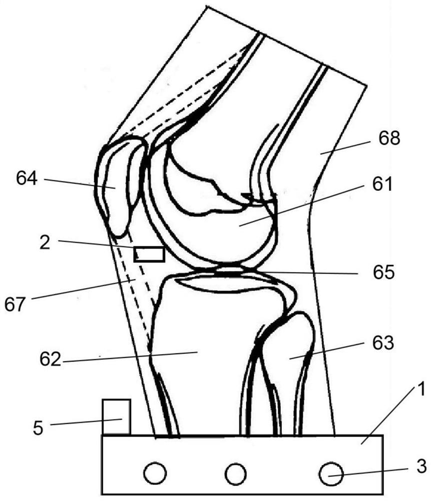 Mongolian medicine three-edged needle acupuncture knee-eye acupoint transparent model