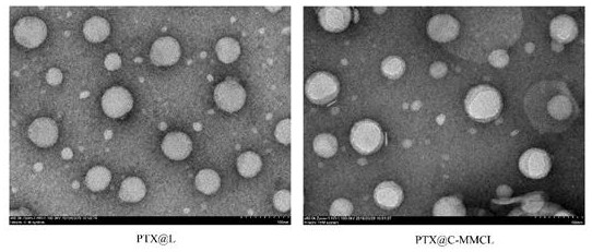 Bionic nano-carrier and application thereof in preparation of brain glioma treatment drugs