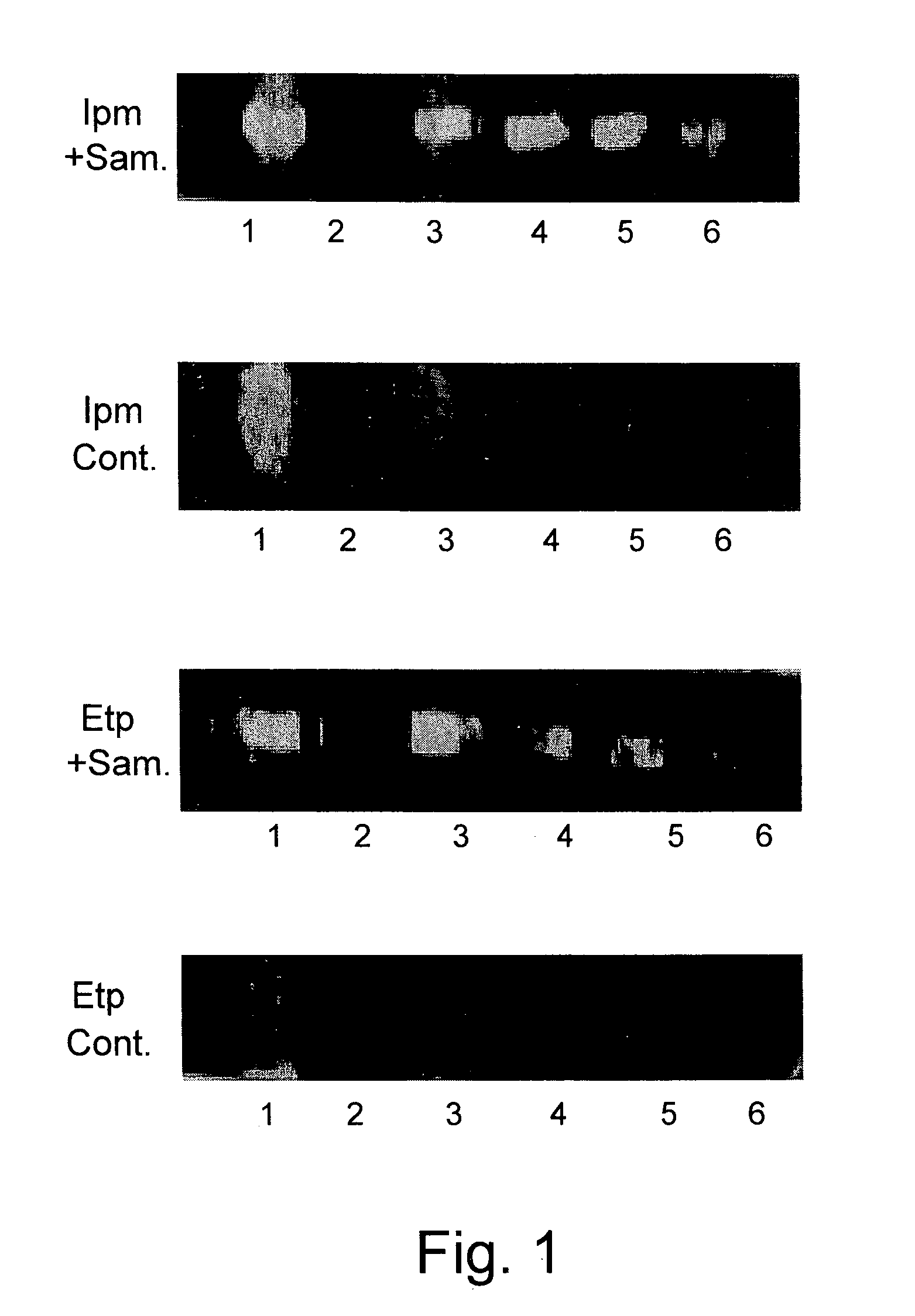 Methods and Kits for Direct Detection and Susceptibility Profiling of Beta-Lactam Resistant Bacteria