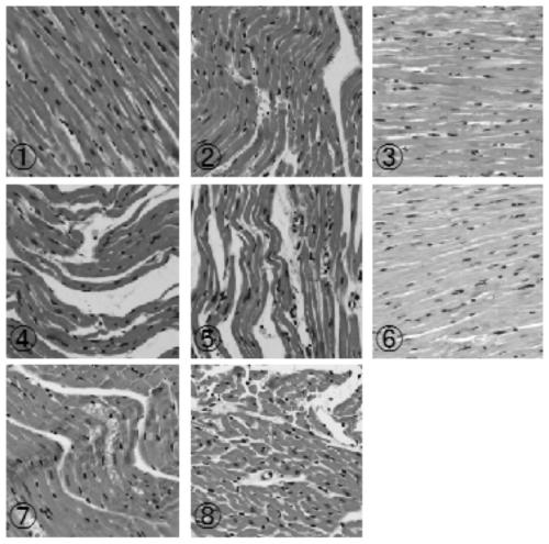 Application of traditional Chinese medicine composition in preparation of medicine for preventing and/or treating myocardial ischemia reperfusion injury