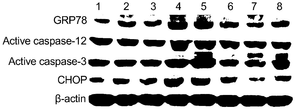 Application of traditional Chinese medicine composition in preparation of medicine for preventing and/or treating myocardial ischemia reperfusion injury