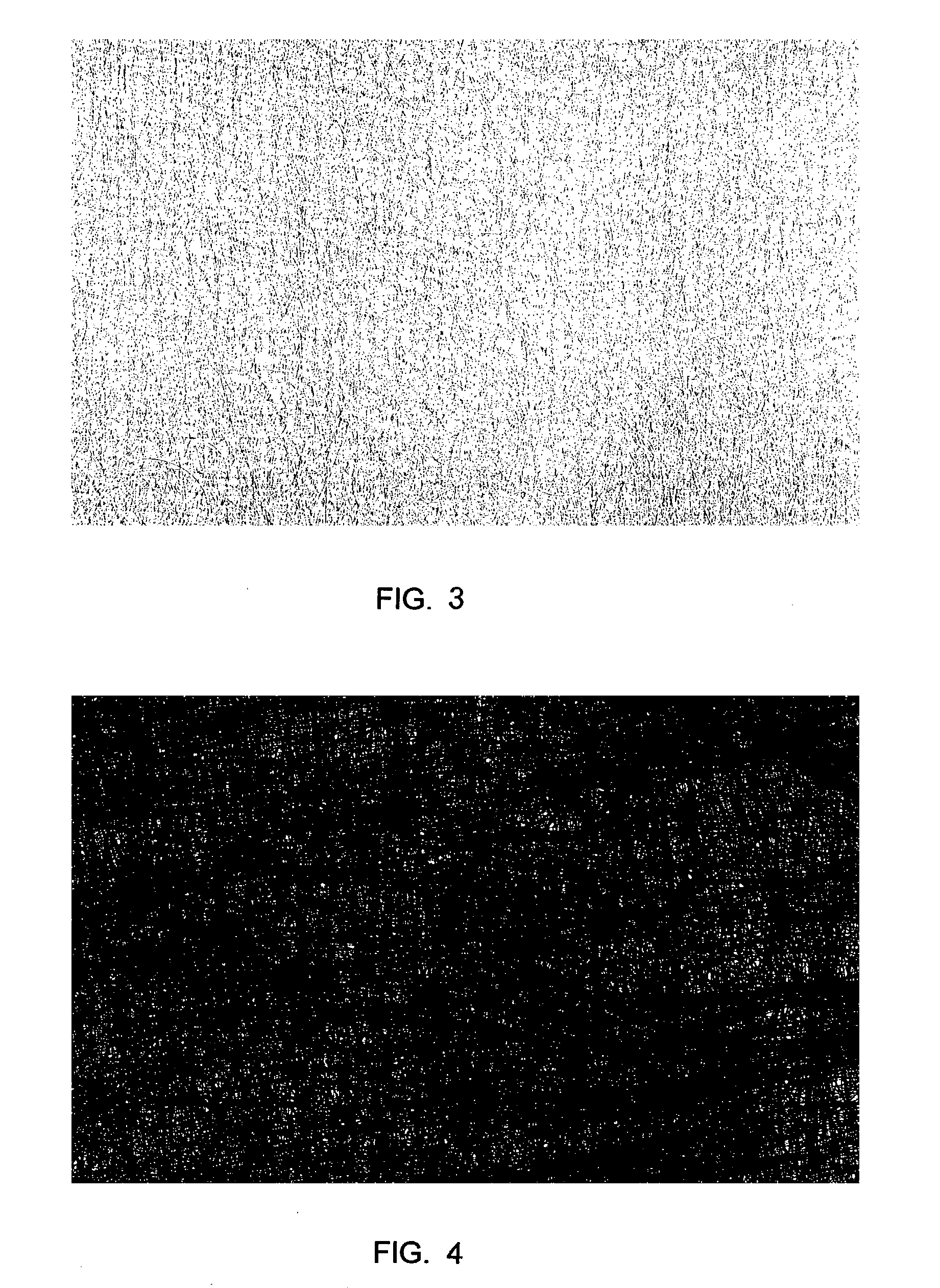 Microporous composite sheet material