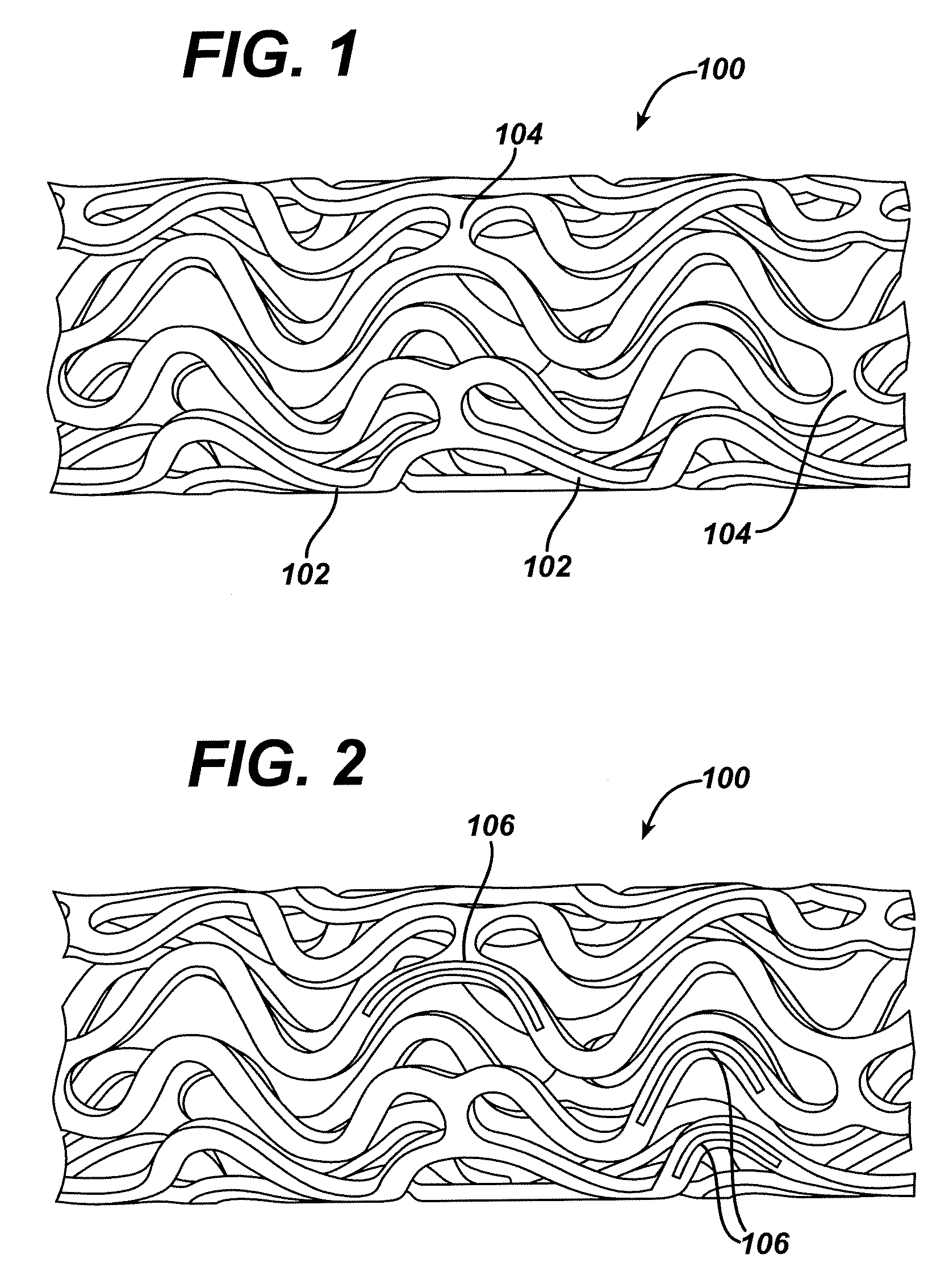 Dual drug stent