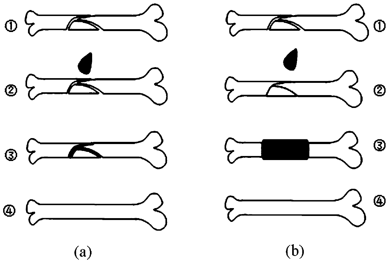 ppf/ppf-da light curing material bone tape