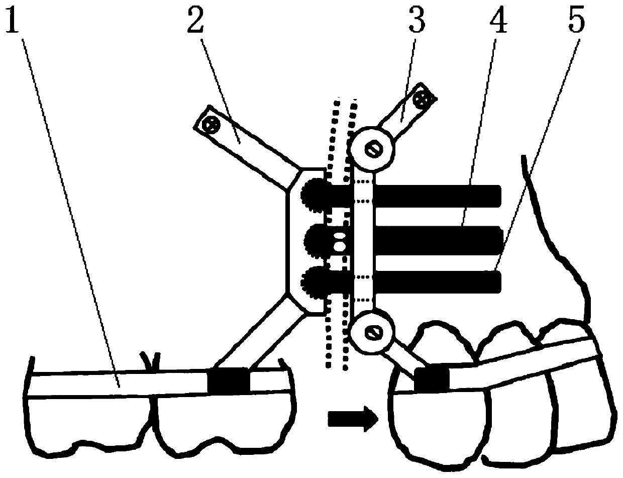 Maxillary protraction distraction device adjustable in direction and clinic application thereof