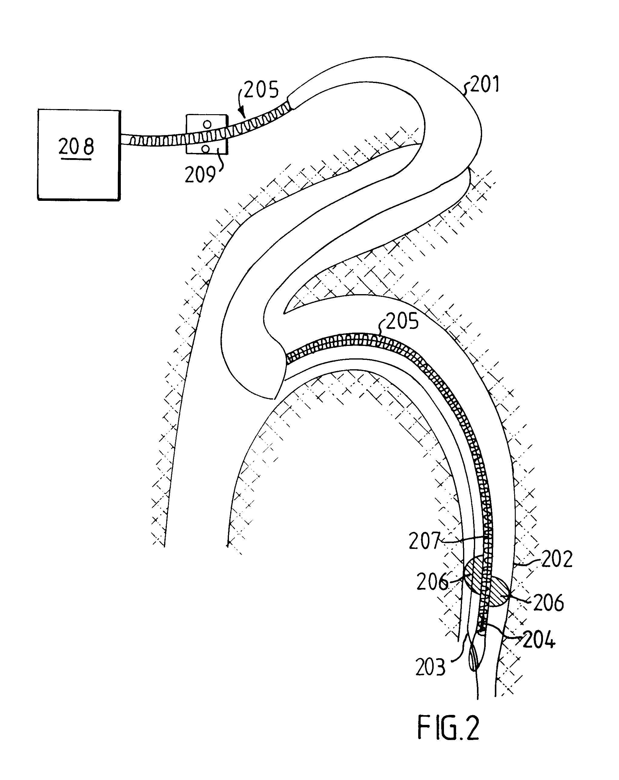 Medical system comprising a miniaturized X-ray tube