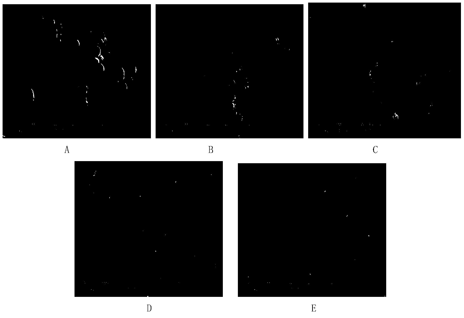 Huperzia serrata endophytic fungus strain and application thereof