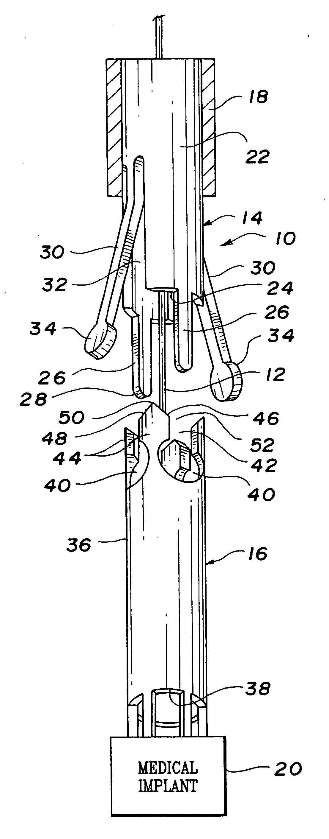 Over-the-wire interlock attachment/detachment mechanism