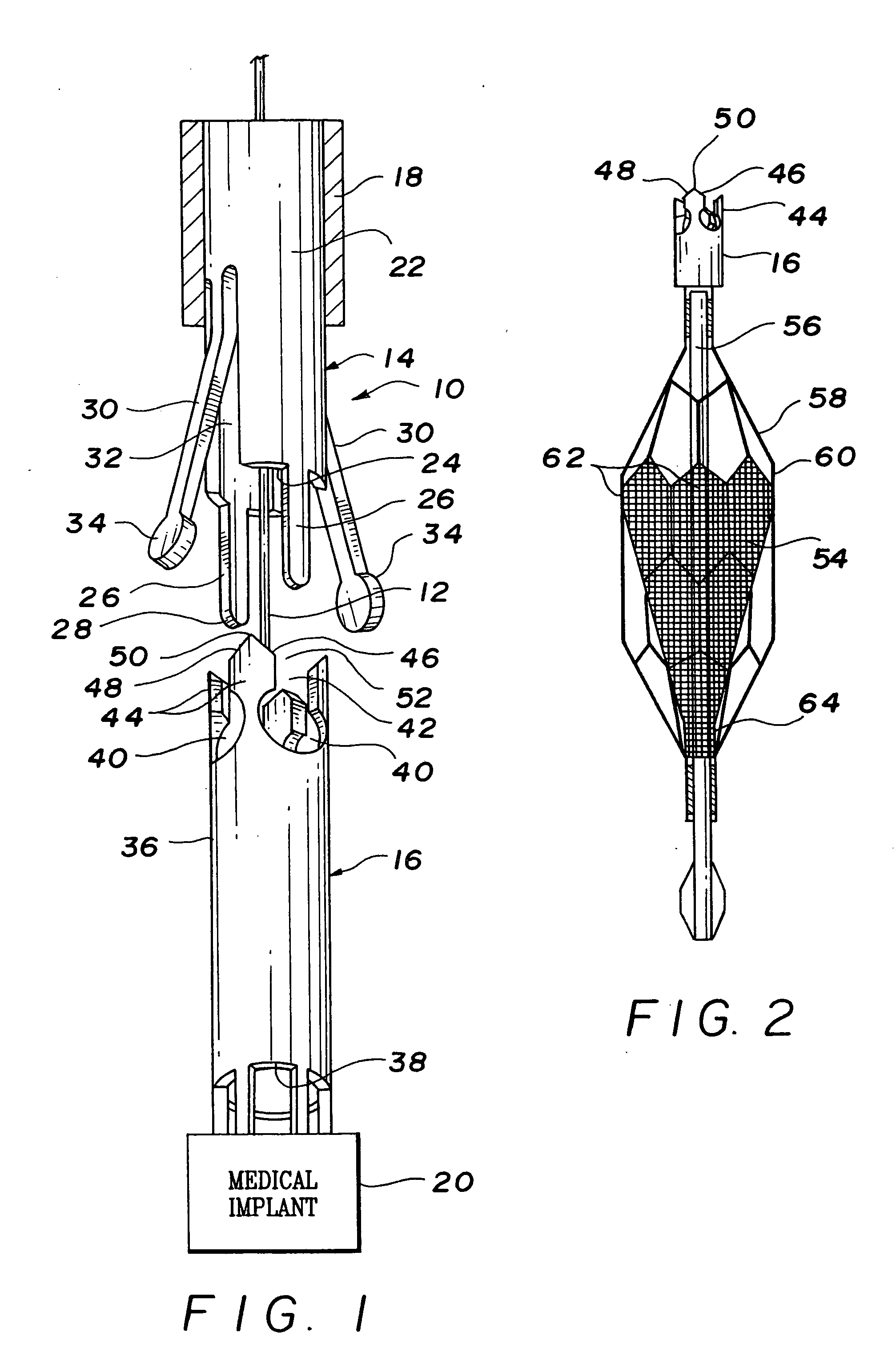 Over-the-wire interlock attachment/detachment mechanism