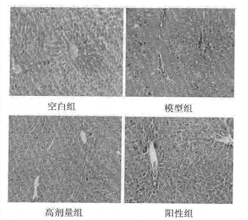 Application of dioscin in preparation of liver-protecting pharmaceutical preparation