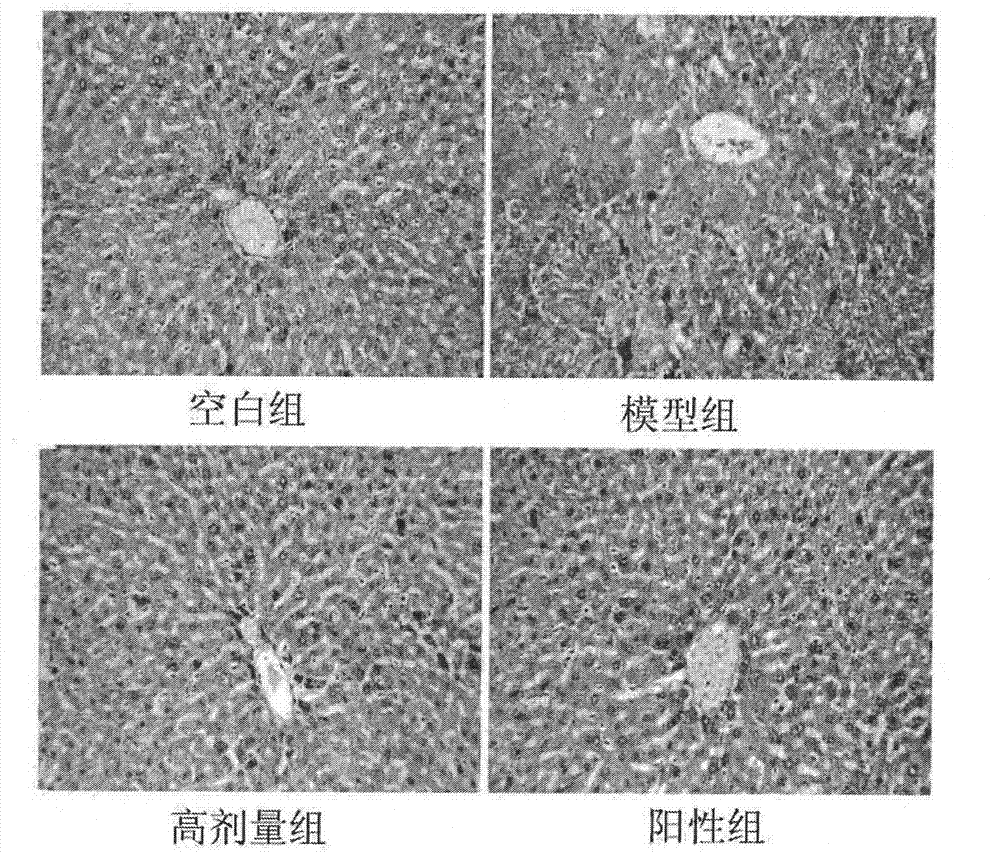 Application of dioscin in preparation of liver-protecting pharmaceutical preparation