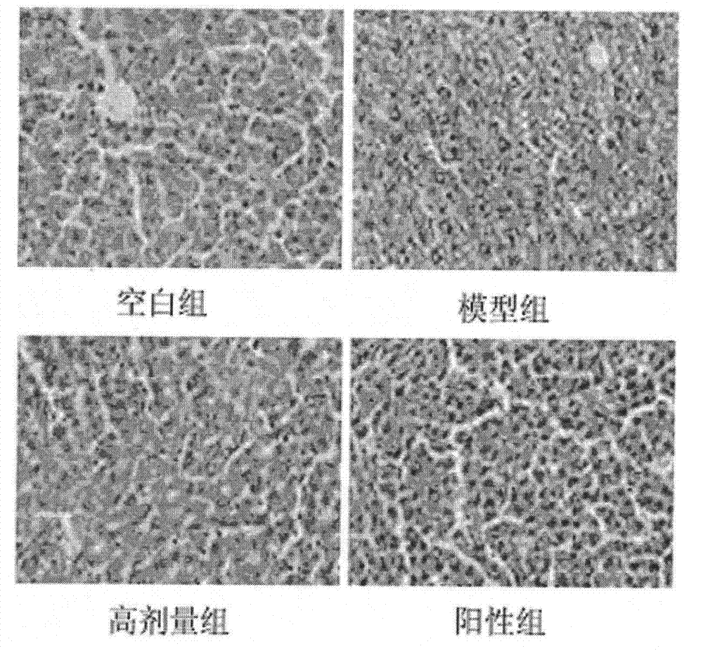 Application of dioscin in preparation of liver-protecting pharmaceutical preparation