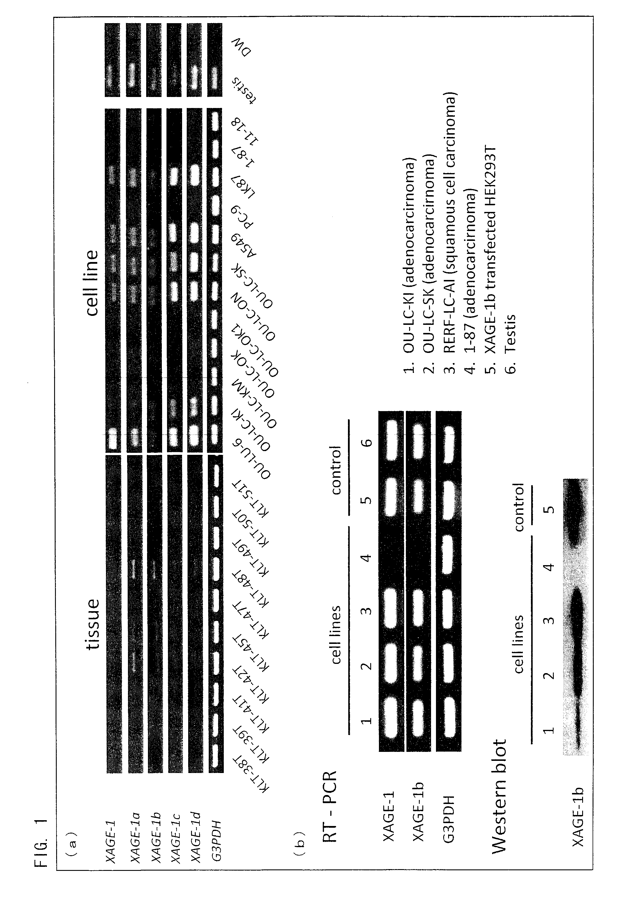 Peptide inducing xage-1b-specific immune reaction and utilization of same