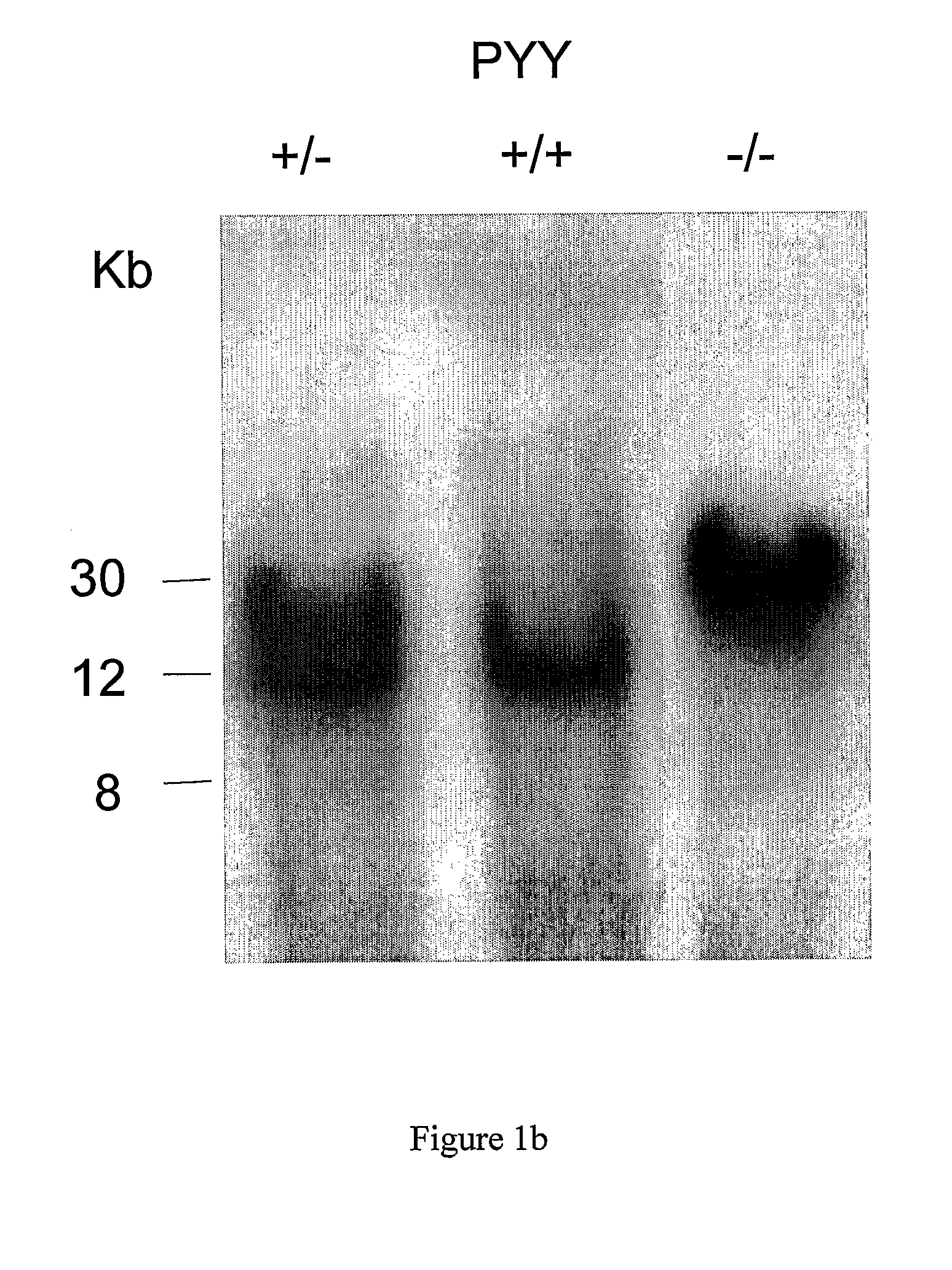 Modified animal lacking functional PYY gene, monoclonal antibodies that bind PYY isoforms and uses therefor