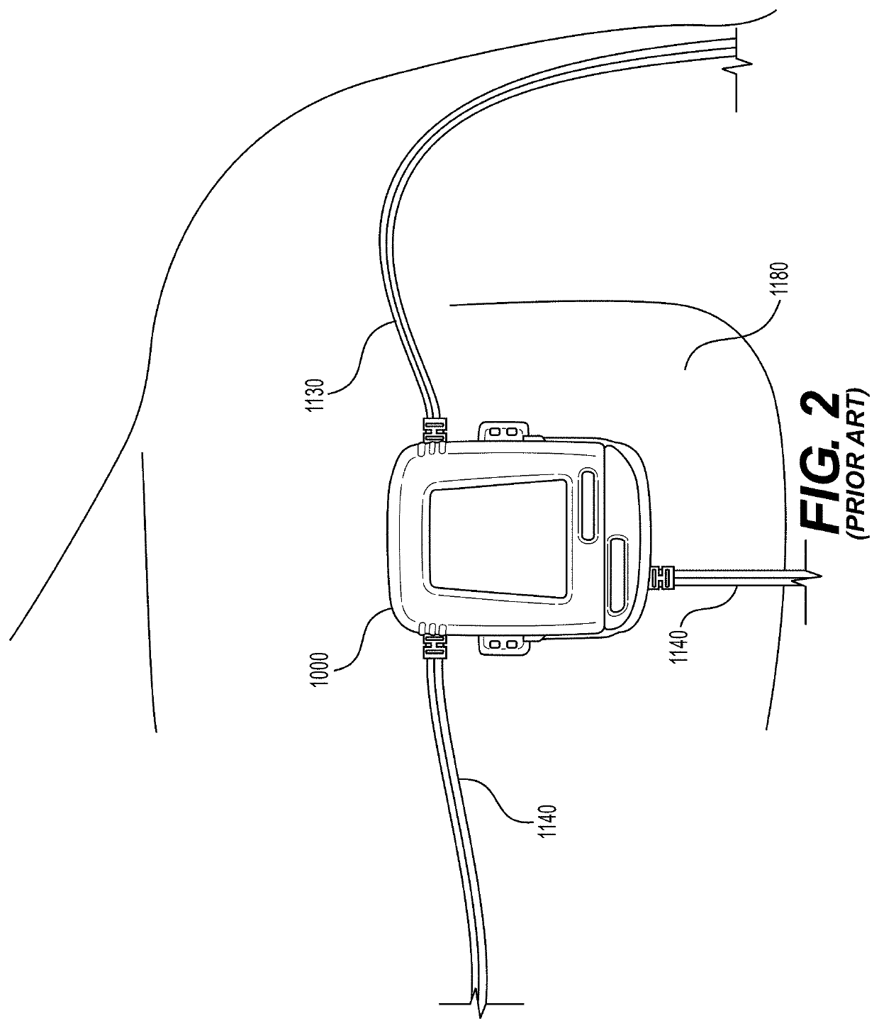 Patient monitoring device