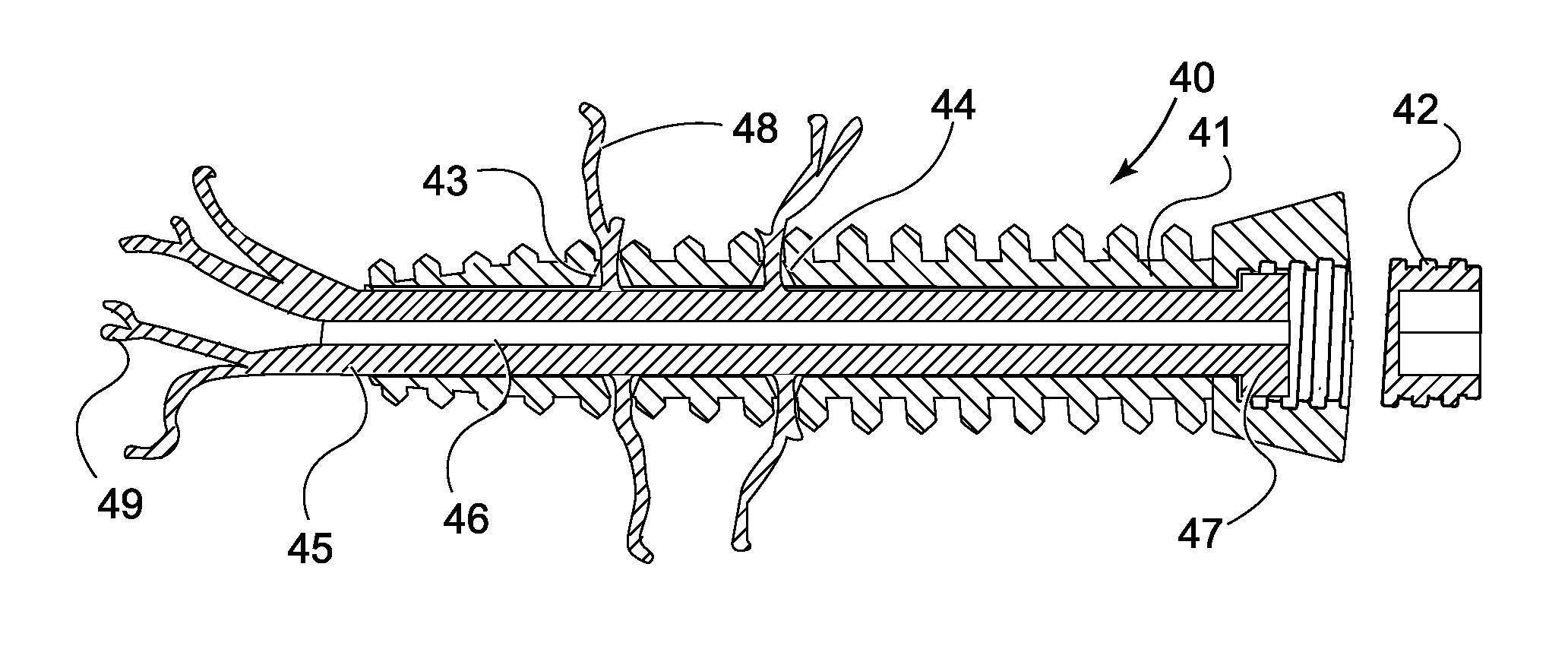 Device and method for orthopedic fracture fixation