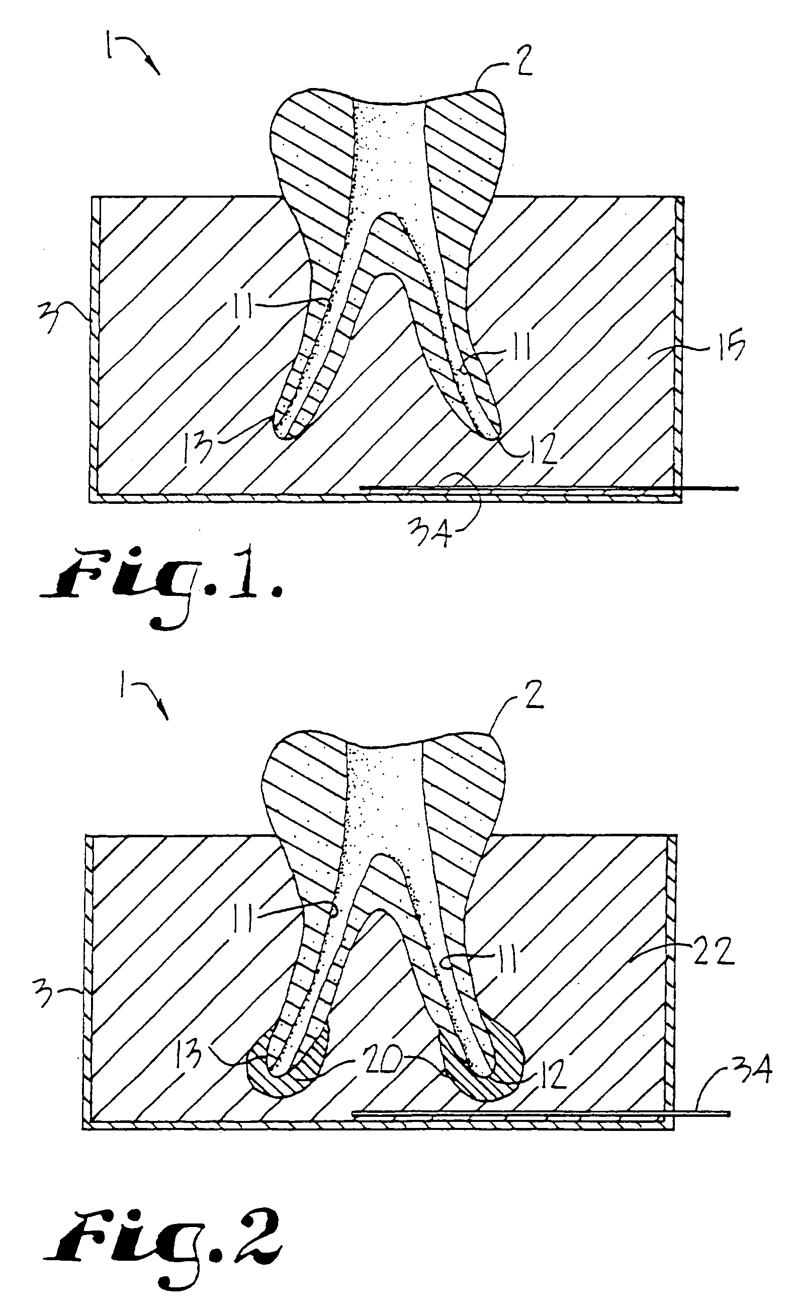 Dental training device