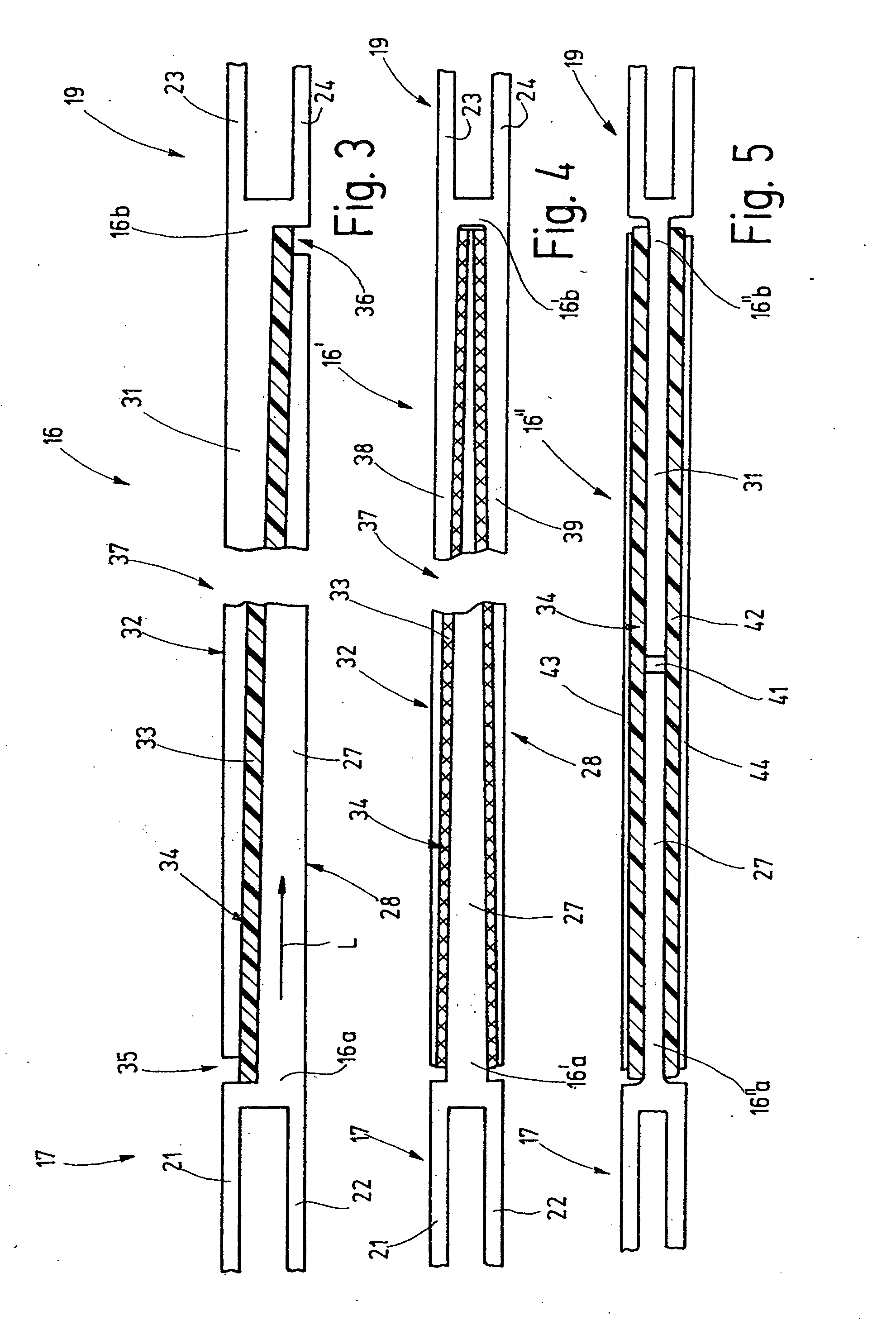 Low-vibration shedding system