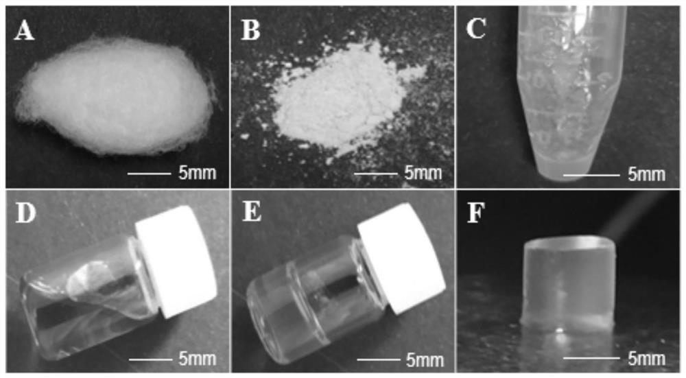 Protein sericin gel based on human platelet-derived growth factor gene silk and its preparation method and application