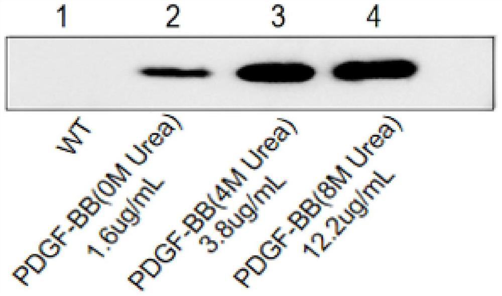 Protein sericin gel based on human platelet-derived growth factor gene silk and its preparation method and application