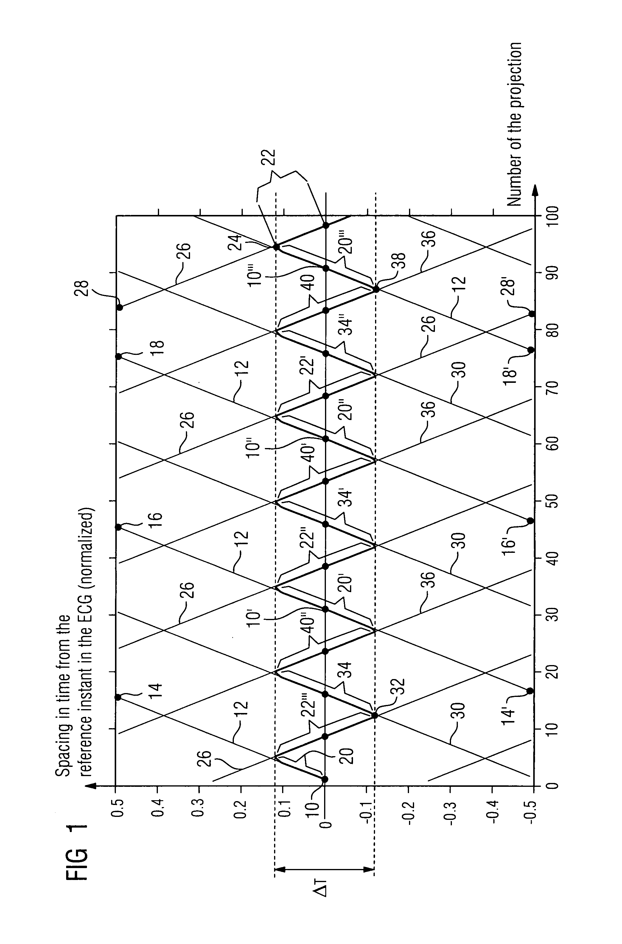 Method for providing a 3D X-ray image dataset of a patient's heart