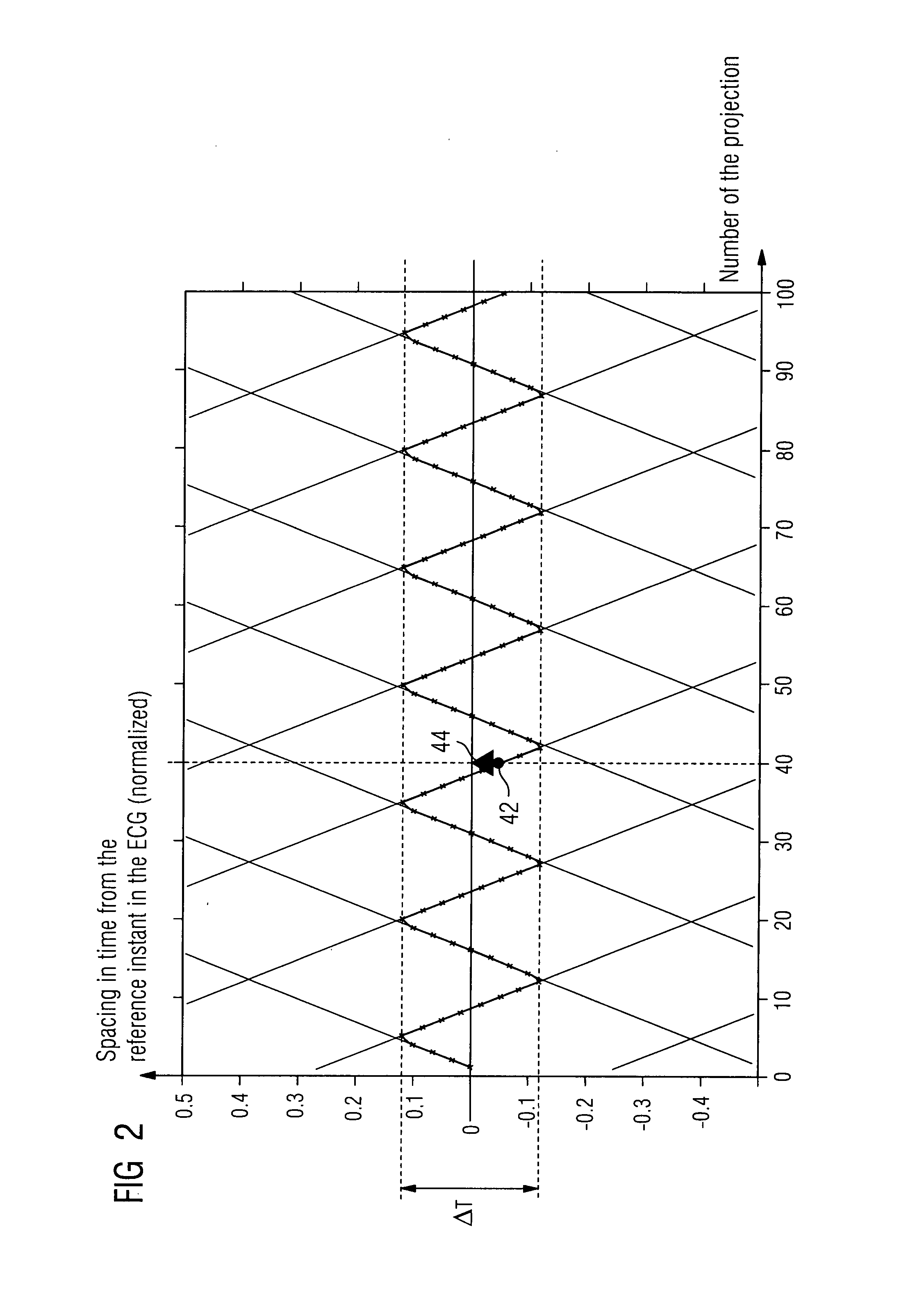 Method for providing a 3D X-ray image dataset of a patient's heart