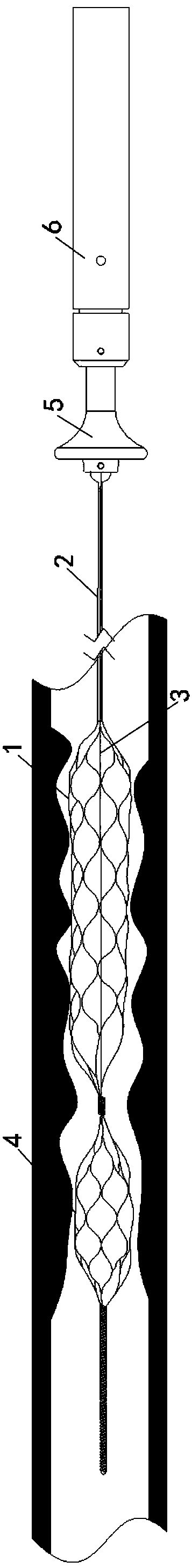 Thrombectomy device