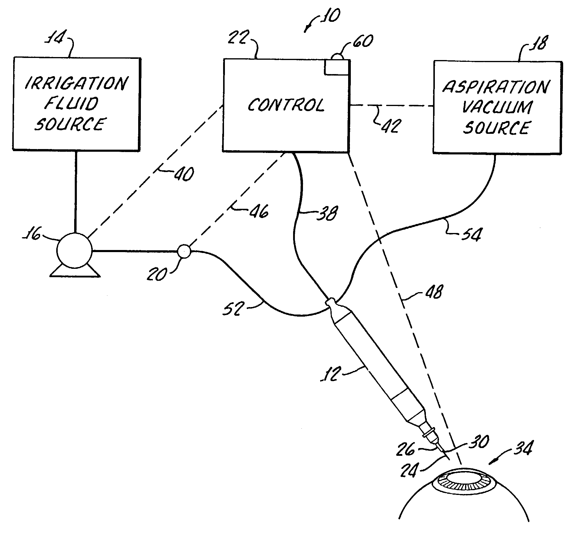 Method for controlling fluid flow to and from an eye during ophthalmic surgery