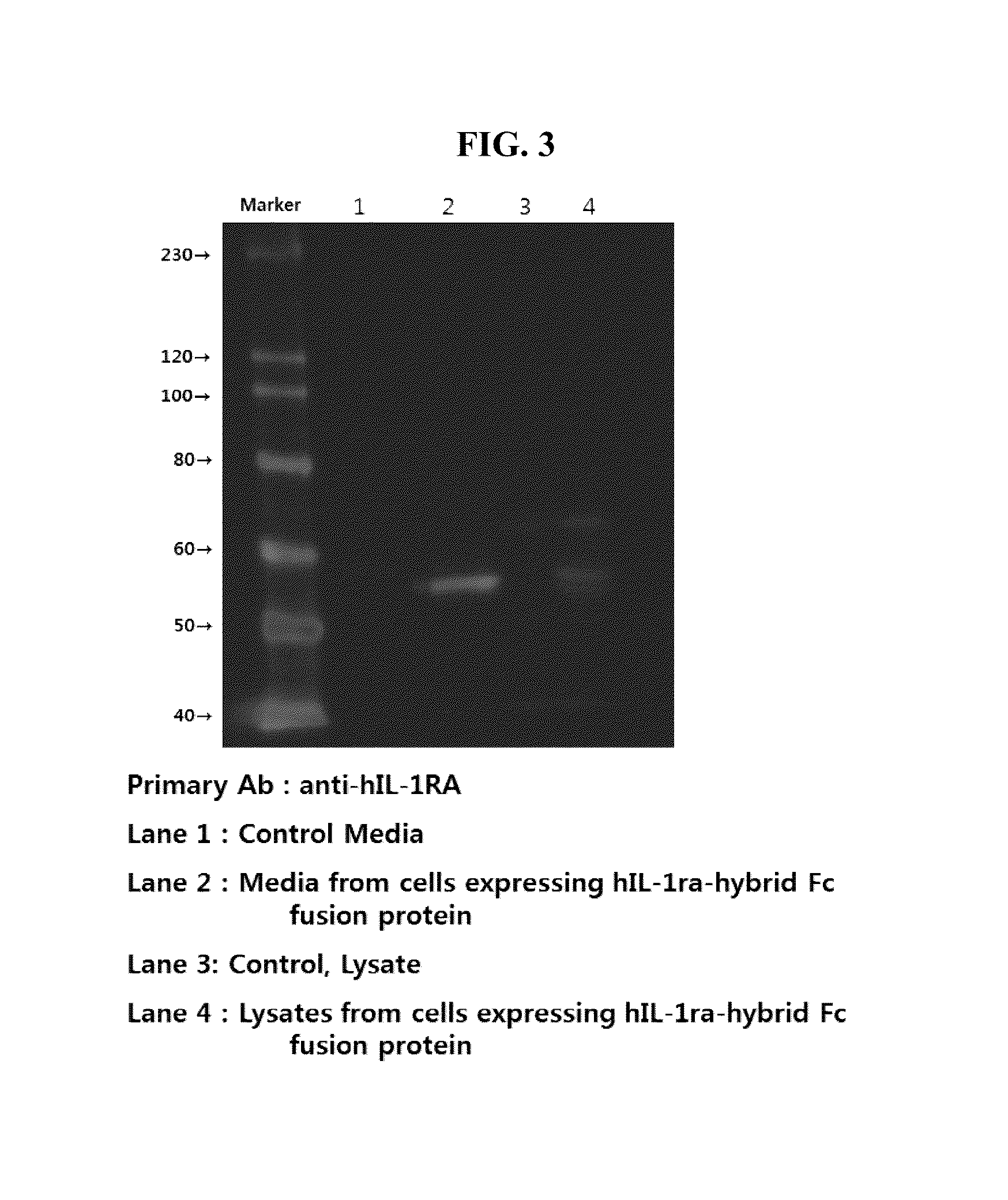 Human interleukin-1 receptor antagonist—hybrid Fc fusion protein