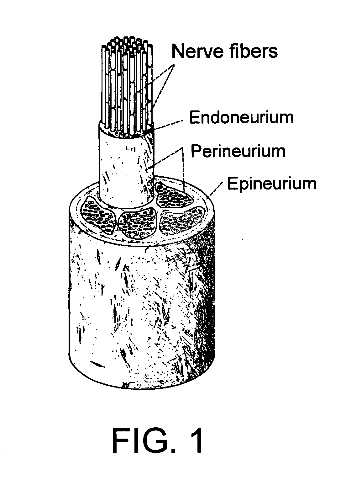 Method and system for providing therapy for autism by providing electrical pulses to the vagus nerve(s)