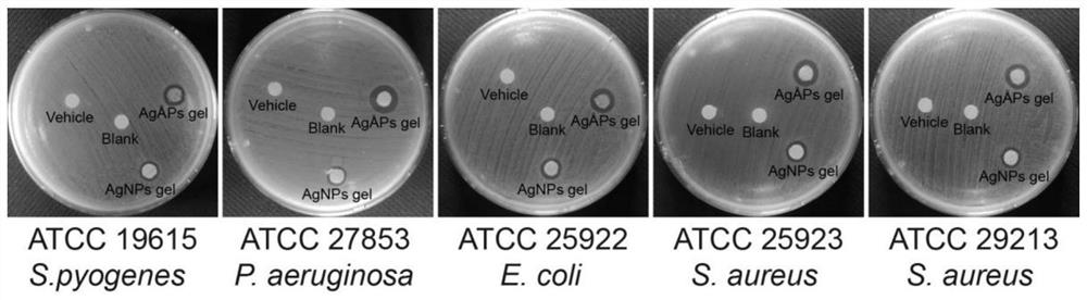 Angstrom silver, Angstrom silver gel for external use, preparation method and application