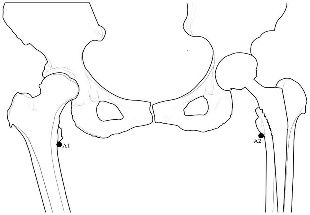 Hip replacement post-operation image evaluation method and system based on deep learning