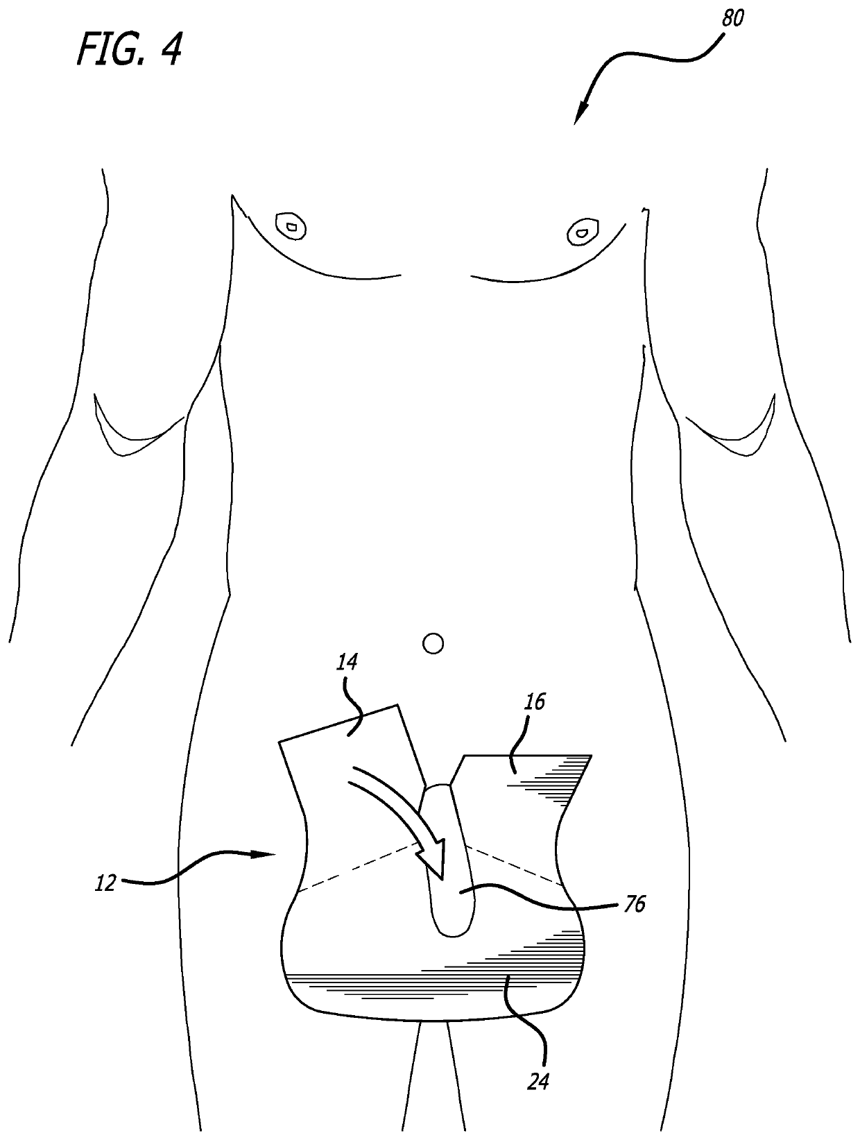 Urine absorbent pad